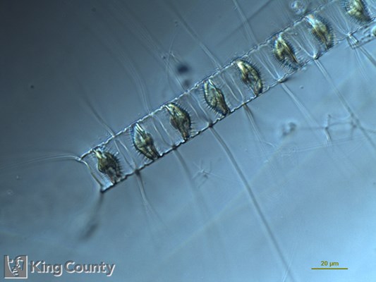 Photo of Chaetoceros vanheurckii